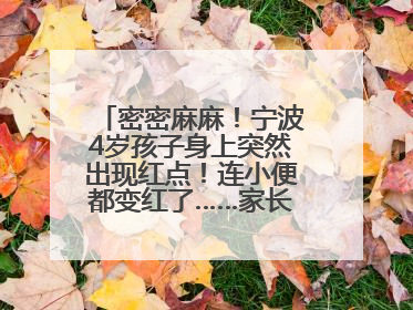 密密麻麻！宁波4岁孩子身上突然出现红点！连小便都变红了……家长：以为只是摔伤